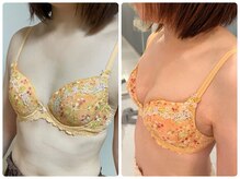 カナエルサロン 旭川(KANAERU SALON)/【バストアップ】症例☆