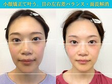 ナチュラルパーフェクトフェイス 新宿