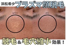 アール(ar.)