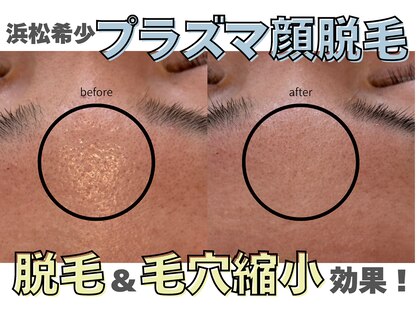 アール(ar.)の写真
