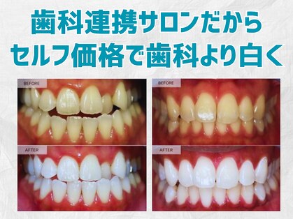 スマイルホワイト 赤羽店の写真