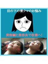 泉町鍼灸整骨院/【目の下のクマ】ご対応してます