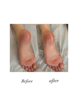 クリスタリオサーナエヌ 自由が丘(crystallo Sana N)/足裏のむくみが直ぐにスッキリ