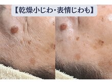 エミナル バイ ニコドット(Eminal by nico.)の雰囲気（【シワ・たるみケア】表情筋をやさしく緩める小顔・筋膜リリース）