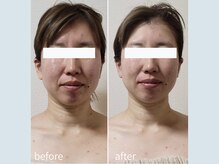 サロン ウル(salon Uru.)/３D立体小顔調整+マッサージ