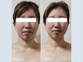 サロン ウル(salon Uru.)/３D立体小顔調整+マッサージ