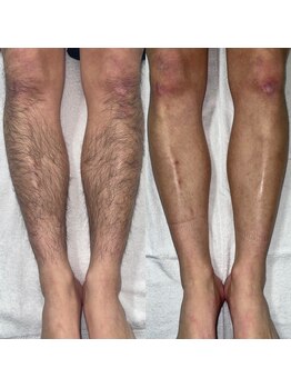 クリア アイラッシーズ アンド ネイルサロン シャイン(CLEAR & SHINE)/