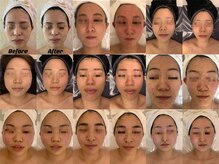 ナラビューティー(NARA BEAUTY)の雰囲気（他のコルギに物足りなさを感じた方必見！恵比寿小顔/小顔コルギ）