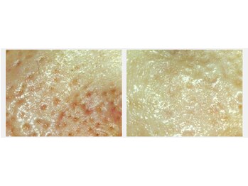 サロン ド ボーテ プルーラ(Salon de beaute PLURA)/別人級の仕上がり!