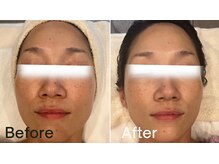 グレイス 高槻店(GRACE)/最強のエイジングケア