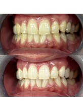 ライトビューティー 池袋店(LightBeauty)/症例写真