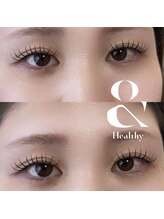 アーニー(ARNY)/&healthy