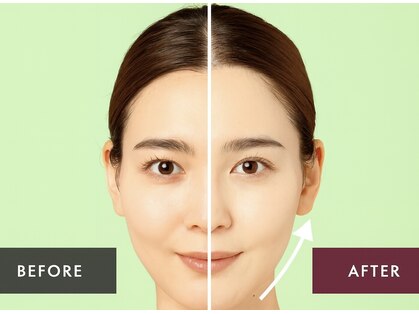 ドクターアーチ 神戸三宮 小顔矯正・整体サロン(Dr.ARCH)の写真