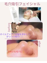 プライベートエステ カモミール/毛穴ケアフェイシャル