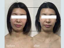 サロン ウル(salon Uru.)/３D立体小顔調整+マッサージ