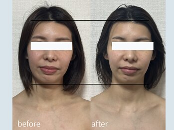 サロン ウル(salon Uru.)/３D立体小顔調整+マッサージ