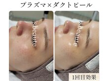 エスボーテ(sbeaute)