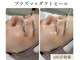 エスボーテ(sbeaute)の写真
