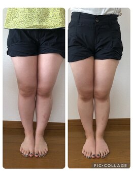 足楽ほんぽ/美脚矯正コース