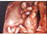 【初回】妊婦整体◎妊娠初期の妊婦ケア/プレナタル整体