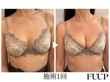 フーアップ 北千住(FU-UP)/バストアップ/育乳（1回）