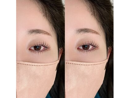 アイミス(Eye'ms)の写真
