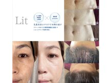 リラスル(Rela x Suru)/Lit