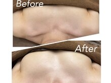 ラ ブリエ(La Briller)/ネックデコルテリンパマッサージ