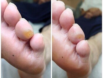 リゼラアンドコー 浦安店/ドイツ式フットケア専門店