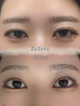 ポタラ(Potala)/大人気メーテルロッド