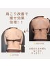 人気NO1【背中・二の腕コース】キャビ+ラジオ波+痩身マッサージ55分¥5,500→