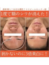 アリュールビューティー 下高井戸店(ALLURE BEAUTY)/ツヤ肌ララピール★