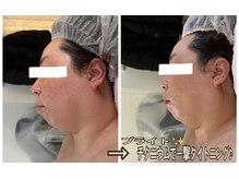 アルページュ(Arpege)/強力タイトニング８０KJ