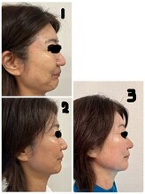 ホーリーハウス(Holy House)/シミ・しわ・たるみに