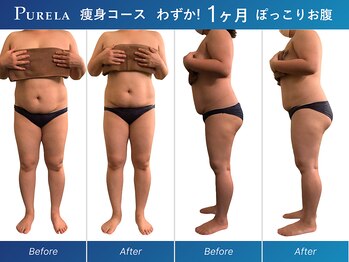 ピュアラ梅田/全身マシン痩身エンダモロジー