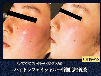 エヴァーグレース 栄店の写真