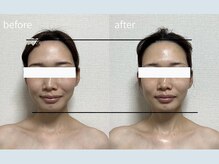 サロン ウル(salon Uru.)/３D立体小顔調整+マッサージ
