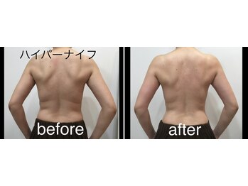 トータルビューティーサロン ナーズ(NAZ)