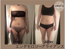 アムール 麻布十番(Amour)/エンダモロジーアライアンス