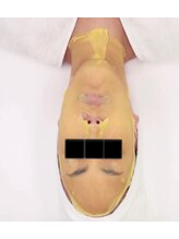 モモン シャルール/乳酸ピーリング・コラーゲン導入