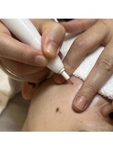 エースマイルイズ(A smile is..)/最強シミケア美容機器【オセロ】