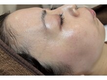 ルアナ ナオ(Luana Nao)/人気No.1スキンケアWax脱毛