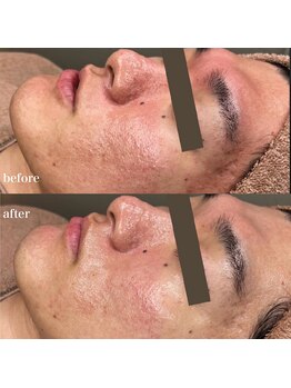 ルミナス(Luminous)/ララピール