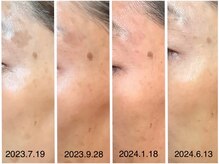 チェシル(CHESIL)