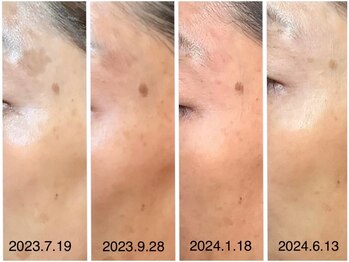 チェシル(CHESIL)