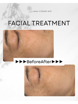 サロン コムモア(salon COMME MOI)/【BeforeAfter】