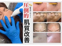 ソリシア(SORISIA)/肌の内側へアプローチするケア