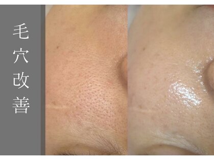 モアナ(Moana)の写真