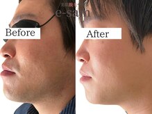 イーサム 高槻摂津富田店(e-sam)/髭脱毛