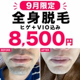 美痩身(bisoshin)